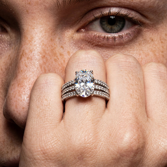 Macro close-up of a large oval diamond ring with a diamond triple band, worn by a freckled model.